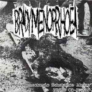 Bradymenorrhoea - Lymphadenectomic Substance Abuse download free